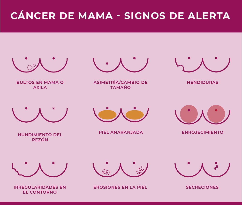 signos cancer de mama